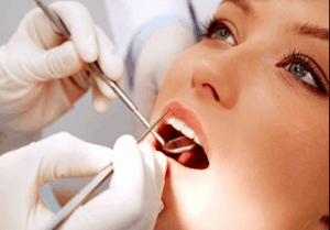 boca aberta, com dentista mexendo - implante dentário